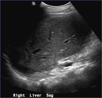 R lobe.jpg