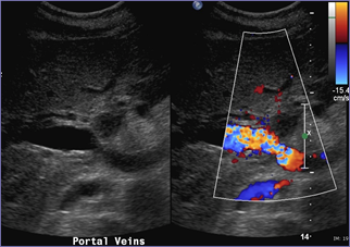 1 imed post op acc 4803426.jpg