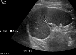 spleen 12-23 11.5cm.jpg