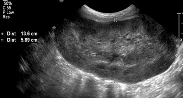 Day 1 Renal TX 1.jpg