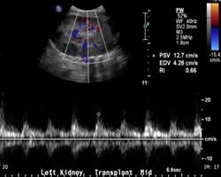 Day 1 Renal TX 3.jpg