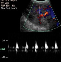 Day 2 Renal TX 5.jpg