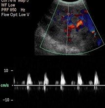 Day 2 Renal TX 5.jpg