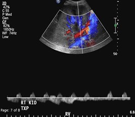 renal vein