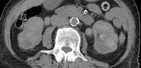 CT 4