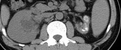 11-07  pre contrast axial