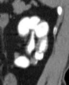 CT sag.jpg