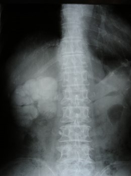 P1010068