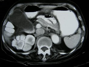 P1010070