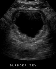 Bladder US trv.jpg