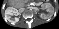 kidneys 2.jpg