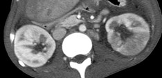 kidneys 1.jpg