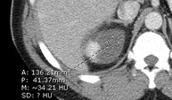 early 1 w density