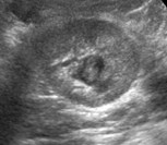 US 2