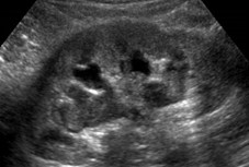 US3