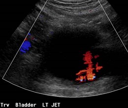 US Bladder, L jet