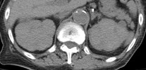 CT 2