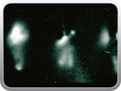 Workers who painted radium on the dials of watches and clocks for luminescence and who wet their brushes by drawing them through their lips developed  an increased incidence of head and neck tumors. This is an autoradiograph taken of one such workers teeth.