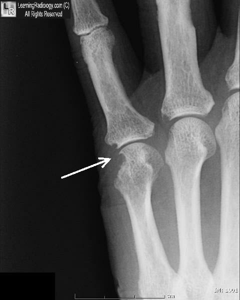 worldwide law companies hanoi